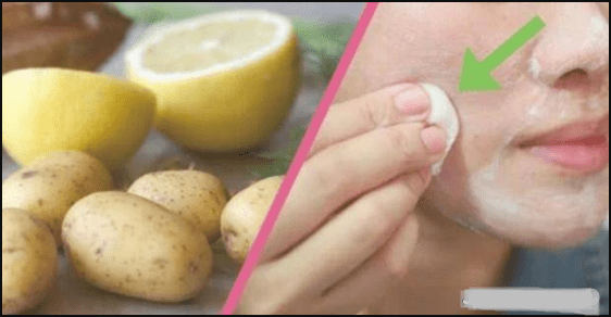 That face pack of potatoes will instantly brighten the skin